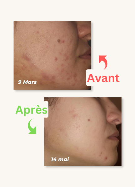 La miraculeuse